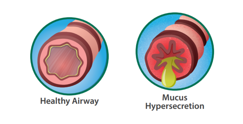 mucus