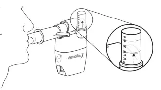 Manometer step 6