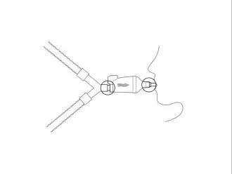 diagram showing how to disconnect the wye from the endotracheal tube