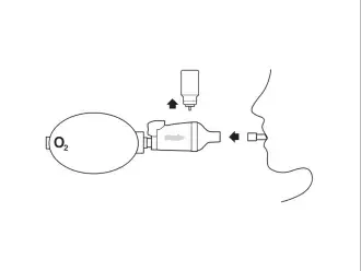 diagram depicting how to remove MDI canister from aerochamber mini