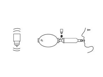 Aerochamber MV-Product-Illustration-Resucitation-How-To-Use-4