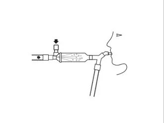 erochamber MV-Product-Illustration-Ventilator-Circuit-How-To-Use-4.