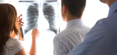 people examining a chest xray