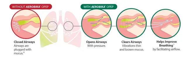 aeroika-diagram-hcp