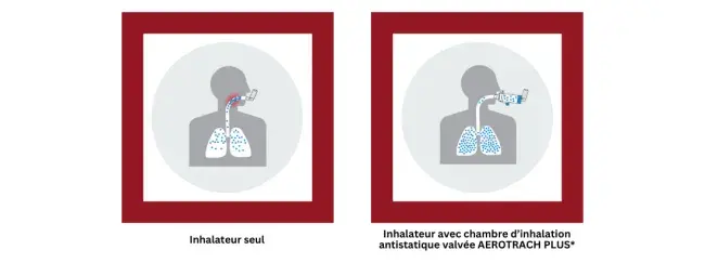 inhalateur seul vs inhalateur avec aerotrach