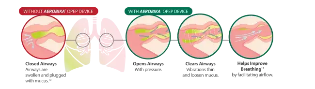 diagram depicting closed airways without aerobika opep device next to open airways with opep device