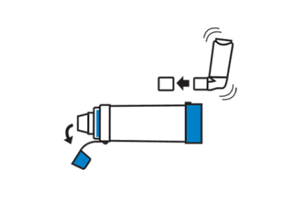 Asthme: comment utiliser un aérosol doseur avec espaceur